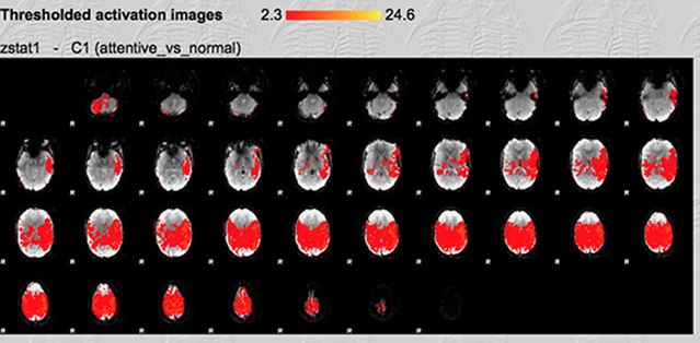 This fMRI scan reveals distinctive increases in brain activity during close reading across multiple brain regions, with strength of activation shown in red for horizontal cross sections of the brain.